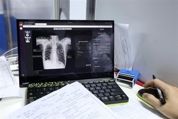 Abogan por intensificar participación de jóvenes vietnamitas en lucha contra tuberculosis ảnh 1 Abogan por intensificar participación de jóvenes vietnamitas en lucha contra tuberculosis ảnh 1