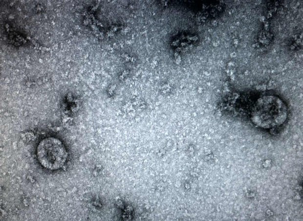 Vietnam tiene suficientes biofármacos para realizar análisis de COVID-19, según funcionario ảnh 1