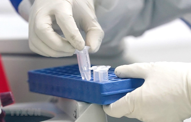 Apoya Japón a Ciudad Ho Chi Minh en lucha contra COVID-19 ảnh 1 Apoya Japón a Ciudad Ho Chi Minh en lucha contra COVID-19 ảnh 1