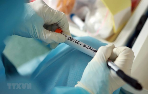 Vietnam prevé contar con 30 laboratorios capaces de analizar pruebas de SARS- CoV-2 ảnh 1 Vietnam prevé contar con 30 laboratorios capaces de analizar pruebas de SARS- CoV-2 ảnh 1