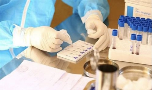 Vietnam suma 94 nuevos casos del COVID-19 ảnh 1 Vietnam suma 94 nuevos casos del COVID-19 ảnh 1