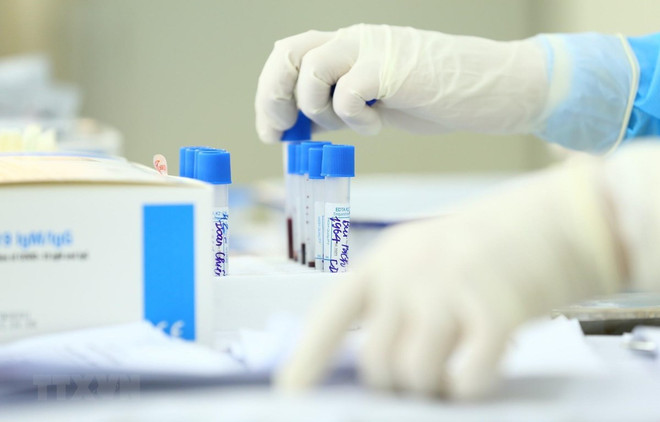 Vietnam reporta otros 22 casos del COVID-19 ảnh 1 Vietnam reporta otros 22 casos del COVID-19 ảnh 1