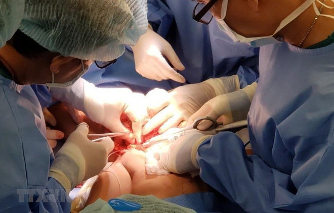 Prensa internacional alaba operación quirúrgica exitosa para separar a siamesas vietnamitas ảnh 1 Prensa internacional alaba operación quirúrgica exitosa para separar a siamesas vietnamitas ảnh 1