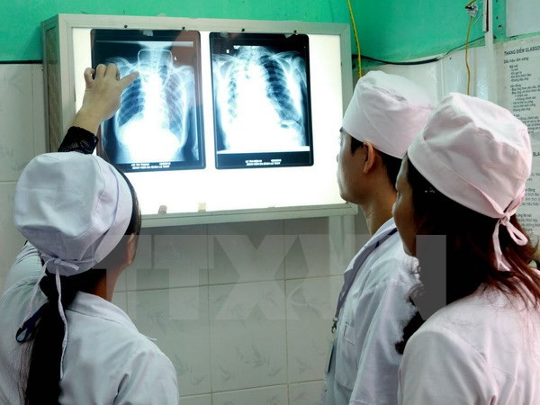 Despliegan en Vietnam programa contra brote de tuberculosis ảnh 1 Despliegan en Vietnam programa contra brote de tuberculosis ảnh 1