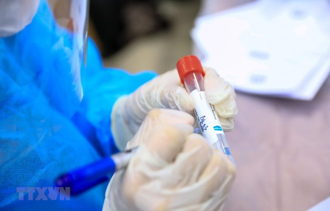 Vietnam registra por primera vez más de mil casos diarios de COVID-19 ảnh 1
