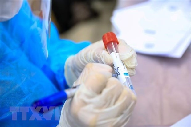 Vietnam: Otros cinco muertos por el COVID-19 ảnh 1