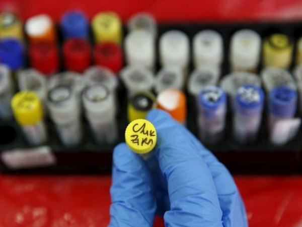 Ministerio de Salud recomienda autoprotección contra dengue y virus Zika ảnh 1 Ministerio de Salud recomienda autoprotección contra dengue y virus Zika ảnh 1