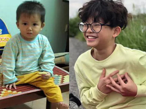 Presentan a italianos historia conmovedora sobre niños vietnamitas con malformaciones ảnh 3 Presentan a italianos historia conmovedora sobre niños vietnamitas con malformaciones ảnh 3