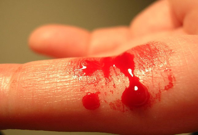 Mitin en Vietnam por elevar conciencia popular sobre hemofilia ảnh 1 Mitin en Vietnam por elevar conciencia popular sobre hemofilia ảnh 1