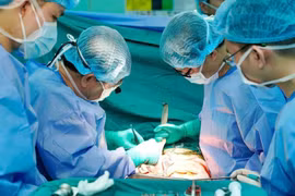 Médicos realizan un trasplante de riñón a un paciente con insuficiencia renal terminal. (Foto: VNA)