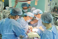 Una trasplante de corazón realizada por el Hospital Central de Hue (Fuente: VNA)