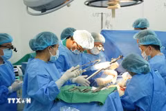 Vietnam realiza con éxito dos trasplantes de pulmón en un día. (Foto: VNA)