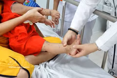 Niño con enfermedad de mano-pie-boca (Foto: VNA)