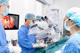 Los médicos realizan una cirugía cerebral a un paciente. (Foto: VNA)