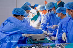 El Hospital Central de Hue realiza un trasplante de riñón utilizando la tecnología de conservación de órganos LifePort. (Foto: VNA)