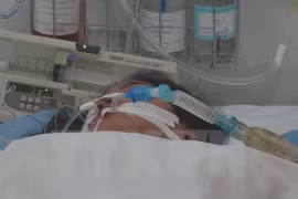 Camboya registra primer caso de muerte por gripe aviar A/H1N1 desde 2010
