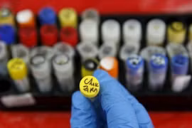 Ministerio de Salud recomienda autoprotección contra dengue y virus Zika