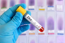 Laos desmiente información sobre primer caso de Zika en 2016