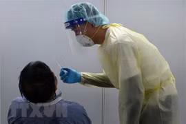 Singapur registra récord de infecciones diarias por COVID-19