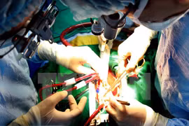 En Ciudad Ho Chi Minh simposio sobre enfermedad cardiaca 