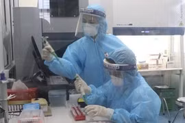 COVID-19: Vietnam reporta 47 nuevos casos del contagio local