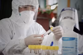 Vietnam confirma 64 nuevos contagios del COVID-19