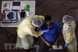 Singapur descubre método de prueba rápido del virus SARS-CoV-2