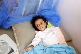 Exhorta Vietnam a combatir el hambre en Yemen