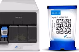 Vietnam por emplear sistema de prueba de tuberculosis en detección del coronavirus