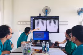 Vietnam recibe software de inteligencia artificial para tratamiento del COVID-19