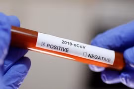 Aumentan a 49 casos infectados de coronavirus en Vietnam 