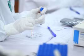 Suman ya 255 pacientes de coronavirus curados en Vietnam