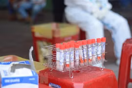 Vietnam reporta 77 casos del contagio local del coronavirus 