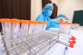 Vietnam no registra nuevos casos de COVID-19