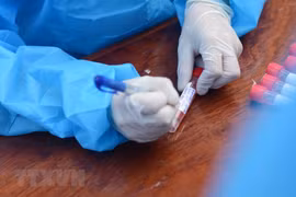 Otros 28 casos confirmados del COVID-19 en Vietnam