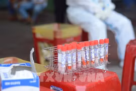 Hanoi propone tres labores clave para prevenir la propagación de COVID-19