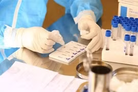 Vietnam suma 94 nuevos casos del COVID-19