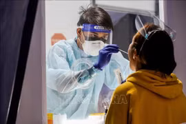 Filipinas registra primer caso de la variante brasileña del virus SARS-CoV-2