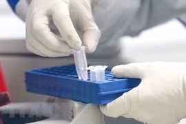 Hanoi rastrea urgentemente casos F1 y F2 del infectado japonés con coronavirus