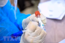 Diagnostican últimos casos mortales del COVID-19 en Vietnam 