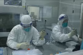 Fallece en Vietnam otra víctima de COVID-19 debido a enfermedades subyacentes