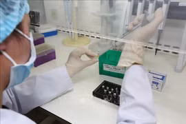 Empresa vietnamita dona 10 mil kits de prueba del COVID-19 al Ministerio de Salud