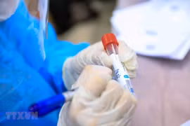 Vietnam registra por primera vez más de mil casos diarios de COVID-19 