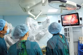  Vietnam realiza con éxito primera operación quirúrgica hepática con robot 