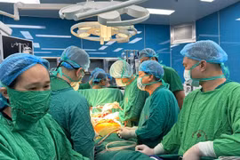 Médicos realizan un trasplante de pulmón a un paciente. (Foto: Vietnam+)