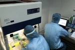 Vietnam puede dominar dos métodos de prueba del virus SARS-CoV-2