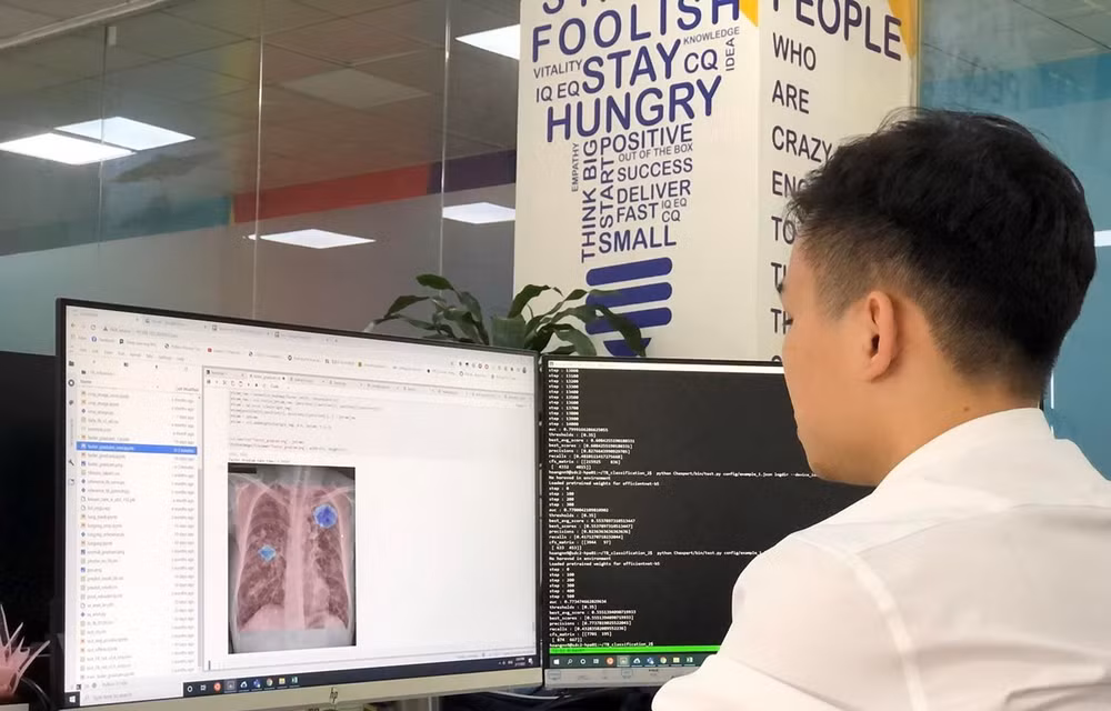 DrAid de Vietnam se destaca entre soluciones de IA en el mundo ảnh 1