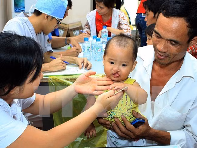 Vicepresidenta vietnamita entrega regalos a niños con defectos faciales ảnh 1