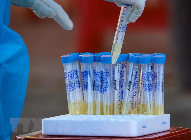 Fallecen en Vietnam otros dos casos del COVID-19 con enfermedades subyacentes graves ảnh 1