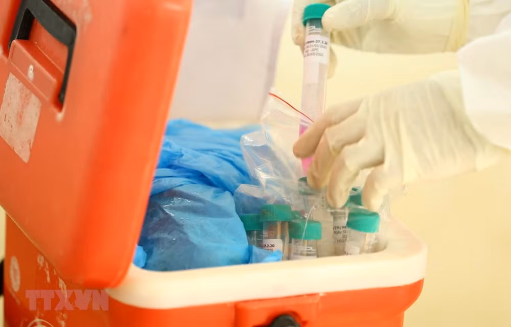  COVID -19: se registra otro fallecido en Vietnam ảnh 1